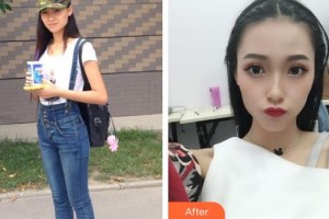 第四軍醫(yī)大學(xué)唐都醫(yī)院整形激光美容中心李金清整形價(jià)格表附假體隆鼻案例展示