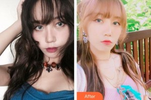 中國醫(yī)學(xué)科學(xué)院整形外科醫(yī)院李養(yǎng)群整形價(jià)格表附激光祛斑案例展示