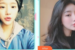 中國(guó)醫(yī)藥城醫(yī)院微創(chuàng)整形美容中心朱寧文整形價(jià)格表附光子嫩膚案例展示