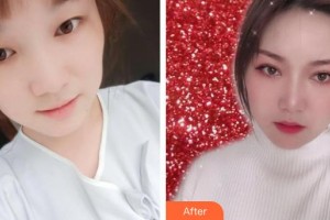 象山愛爾眼科醫(yī)院賈知微整形價(jià)格表附埋線雙眼皮案例展示