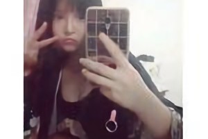 上海華美醫(yī)院李志海做的下頜角貴嗎？附案例日記分享