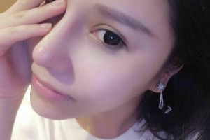 同濟大學附屬東方醫(yī)院醫(yī)生團隊如何？附隆鼻手術(shù)附果圖展示