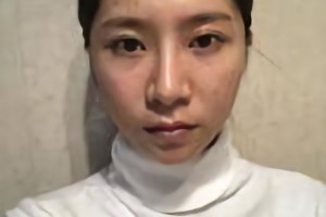 上海仁愛醫(yī)院劉先超磨骨怎么樣？附案例分享和較新價格表