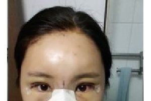 上海大附屬九院整形科如何？附實拍案例+醫(yī)生介紹