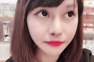 河北醫(yī)科大學(xué)第二醫(yī)院整形美容科隆鼻果好不好附案例和價格表