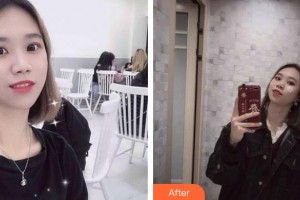 郴州瑞瀾醫(yī)療美容醫(yī)院黃敏建整形價格表附清潔祛痘案例展示