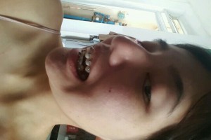 歡樂口腔醫(yī)院孫延牙齒矯正？醫(yī)生推薦+費用表