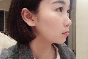 長沙美奧口腔醫(yī)院環(huán)境怎么樣熊安鳳牙齒矯正附果圖和價格表