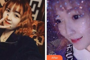 西昌口腔醫(yī)院王秀華整形價格表附超聲波潔牙案例展示