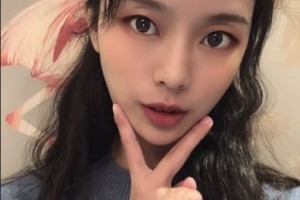 上海首爾麗格醫(yī)療美容醫(yī)院樸興植顴骨手術(shù)附果圖