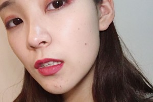 沈陽軍區(qū)總醫(yī)院割雙眼皮果好嗎附陶凱醫(yī)生案例和價格表