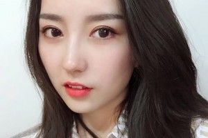 上海星璨國際整形硬件設(shè)施怎么樣張勍楓隆鼻手術(shù)好不好附案例