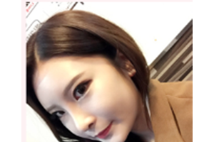 泉州市第一醫(yī)院口碑怎么樣林偉年隆鼻日記分享附價格一覽