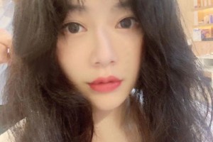 北京大學(xué)第三醫(yī)院環(huán)境怎么樣閆愛萍醫(yī)生植發(fā)手術(shù)果分享和價(jià)格表