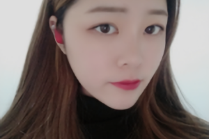 杭州時光醫(yī)療美容醫(yī)院河東鎬醫(yī)生怎么樣？附磨骨案例分享和價格表