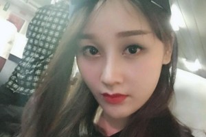 臺州椒江維多利亞整形美容門診部魏萍隆鼻手術(shù)附果圖分享