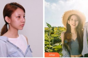 雞西王醫(yī)生整形外科門診部呂睿纮整形價(jià)格表附硅膠隆鼻案例展示