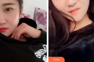 雞西王杰口腔診所王杰整形價(jià)格表附根管調(diào)節(jié)案例展示