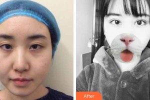 乳山新視力眼科醫(yī)院初日旭整形價(jià)格表附眼部綜合案例展示