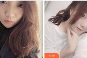 石獅寶島栢麗醫(yī)療美容醫(yī)院范善進(jìn)主診醫(yī)師整形價(jià)格表附激光祛斑案例展示