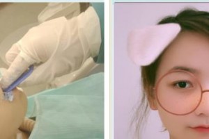 石獅寶島栢麗醫(yī)療美容醫(yī)院楊三香整形價(jià)格表附牙齒隱形矯正案例展示