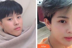 諸暨愛爾眼科醫(yī)院唐靜曉整形價格表附外切祛眼袋案例展示