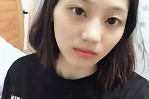 廣州廣大醫(yī)院王政醫(yī)生磨骨好不好附案例和價格一覽