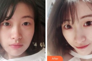 惠陽長安醫(yī)院整形美容中心李文珍整形價格表附鼻部綜合案例展示