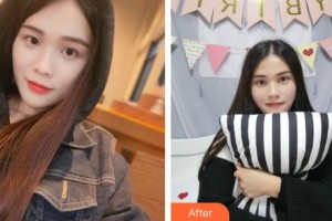 龍口光明眼科醫(yī)院尤力整形價格表附眼部綜合案例展示