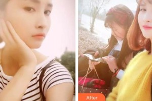 濟(jì)源霍氏口腔醫(yī)院石明軍整形價格表附美白劑美白牙齒案例展示