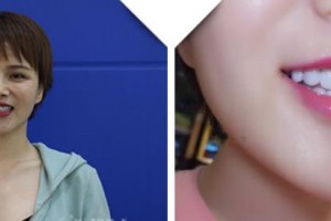 大理麗顏醫(yī)學(xué)整形美容診所陳方中整形價格表附牙貼面案例展示