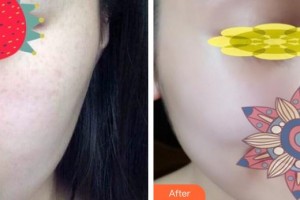 大理麗顏醫(yī)學(xué)整形美容診所楊成整形價格表附補(bǔ)水保濕案例展示