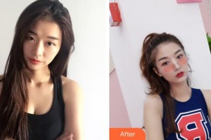 邯鄲華美醫(yī)療美容醫(yī)院陳穎整形價格表附眼部綜合案例展示