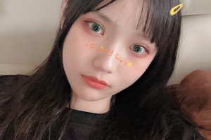 豐臺右安門醫(yī)院顴骨手術(shù)|附果圖+新版價格表