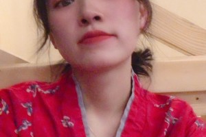 北京聯(lián)合麗格醫(yī)院怎么樣下頜角切除手術(shù)展示|價格表