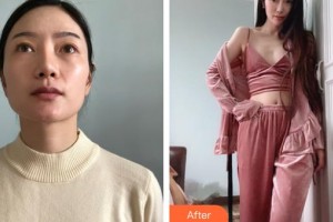 邯鄲曲勝星范醫(yī)療美容門診部顏紅亮整形價(jià)格表附切開雙眼皮案例展示