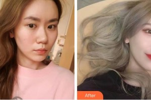 邯鄲中信皮膚科門診部武賀慶整形價(jià)格表附眼部綜合案例展示