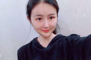 廣東美恩整形美容醫(yī)院下頜角手術(shù)附果圖！