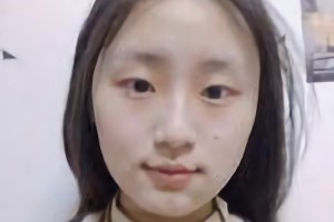 北京圣嘉榮醫(yī)療美容醫(yī)院口碑怎么樣？附案例分享|醫(yī)生推薦