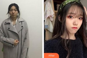 邯鄲市眼科醫(yī)院史偉整形價(jià)格表附眼部綜合案例展示