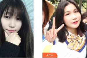 邯鄲愛爾眼科醫(yī)院馬書梅整形價格表附眼部修復(fù)案例展示