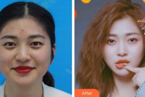 漢口愛爾眼科醫(yī)院雷曉華整形價(jià)格表附眼部綜合案例展示