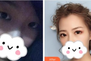 漢口愛爾眼科醫(yī)院姜黎整形價(jià)格表附眼部綜合案例展示