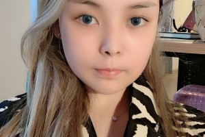 暨南大學(xué)附屬深圳華僑醫(yī)院顴骨手術(shù)附果圖