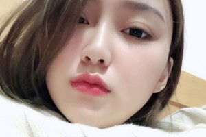 北京圣嘉新醫(yī)院下頜角手術(shù)|案例分享+名醫(yī)推薦