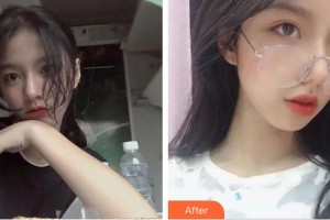 深圳市眼科醫(yī)院劉欣華整形價(jià)格表附眼部綜合案例展示