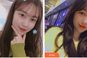 深圳愛爾眼科醫(yī)院徐洋濤整形價格表附切開雙眼皮案例展示