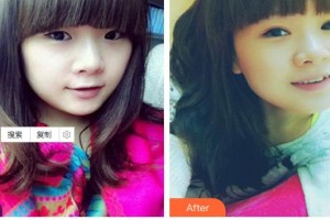 深圳?，斄猪槼毖劭漆t(yī)院施尼可整形價格表附眼部綜合案例展示