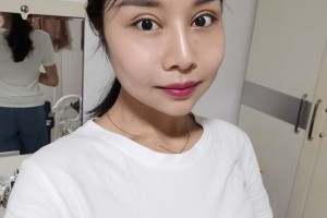 北京麗都醫(yī)療美容醫(yī)院顴弓外擴(kuò)整形果？真實(shí)案例對(duì)比