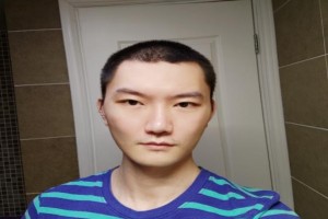 韓國(guó)Face-line整形醫(yī)院真人案例分享|2021價(jià)格表